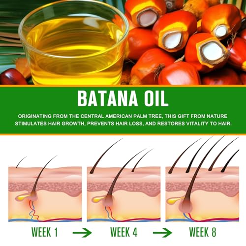 Rosemary Oil for Hair Growth, Pure for Scalp and Eyebrow V162100