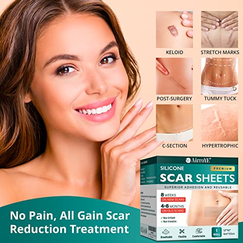 Silicone Scar Sheets for Surgical, Keloid, and C-Section Scars Z84648