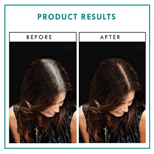 Root Concealer Touch Up Spray - Quick Drying, Water-Resistant Temporary Hair Color for Gray Roots - 2 oz L850477
