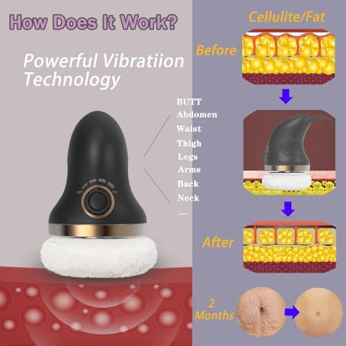 Handheld Cellulite Massager with Lymphatic Drainage for Body Sculpting W20507