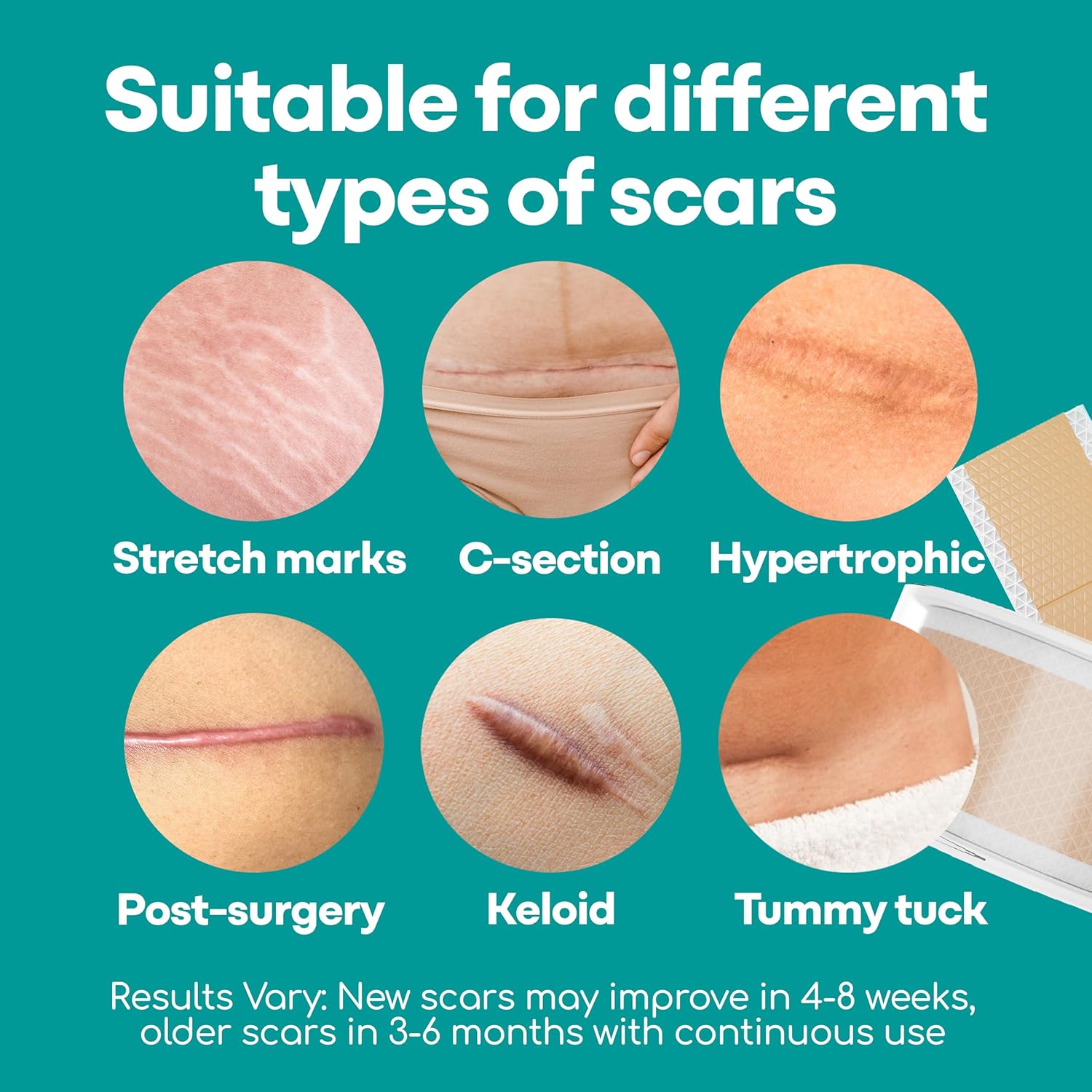 Silicone Scar Sheets, 80 Inches Long, Reusable with Storage Case L347