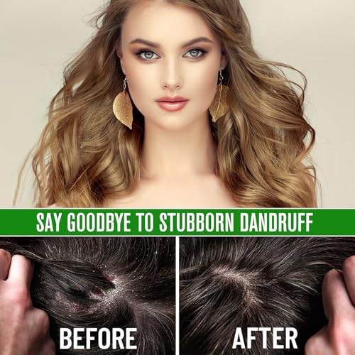 Rosemary Oil for Hair Growth, Pure for Scalp and Eyebrow V162100