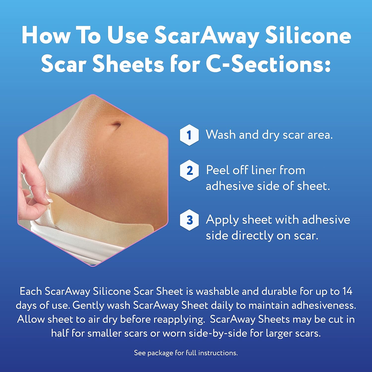 Silicone Scar Sheets for C-Section, Reusable, 4 Sheets U386