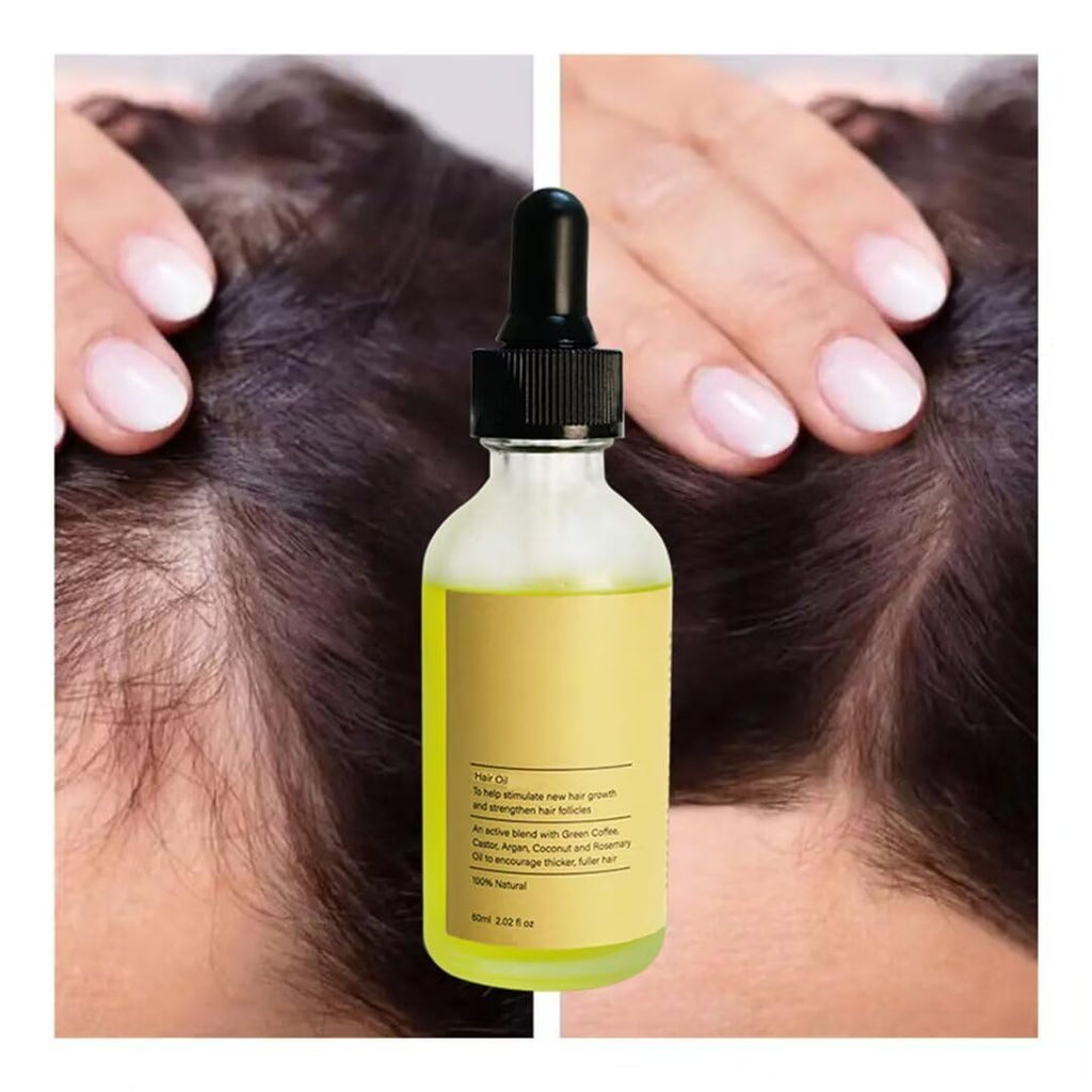 Rosemary and Parsley Seed Hair Growth Oil for Dry Scalp and Split Ends I952