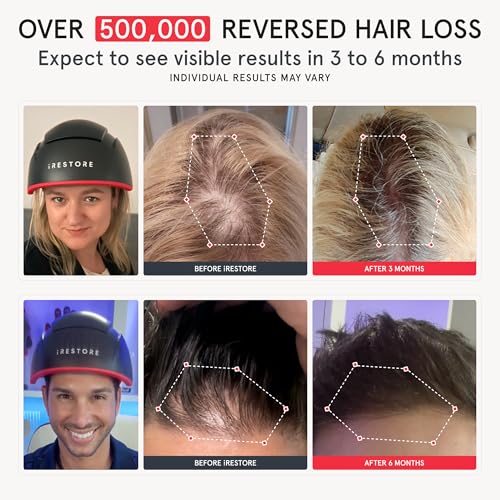 Red Light Therapy Cap for Hair Regrowth H72790