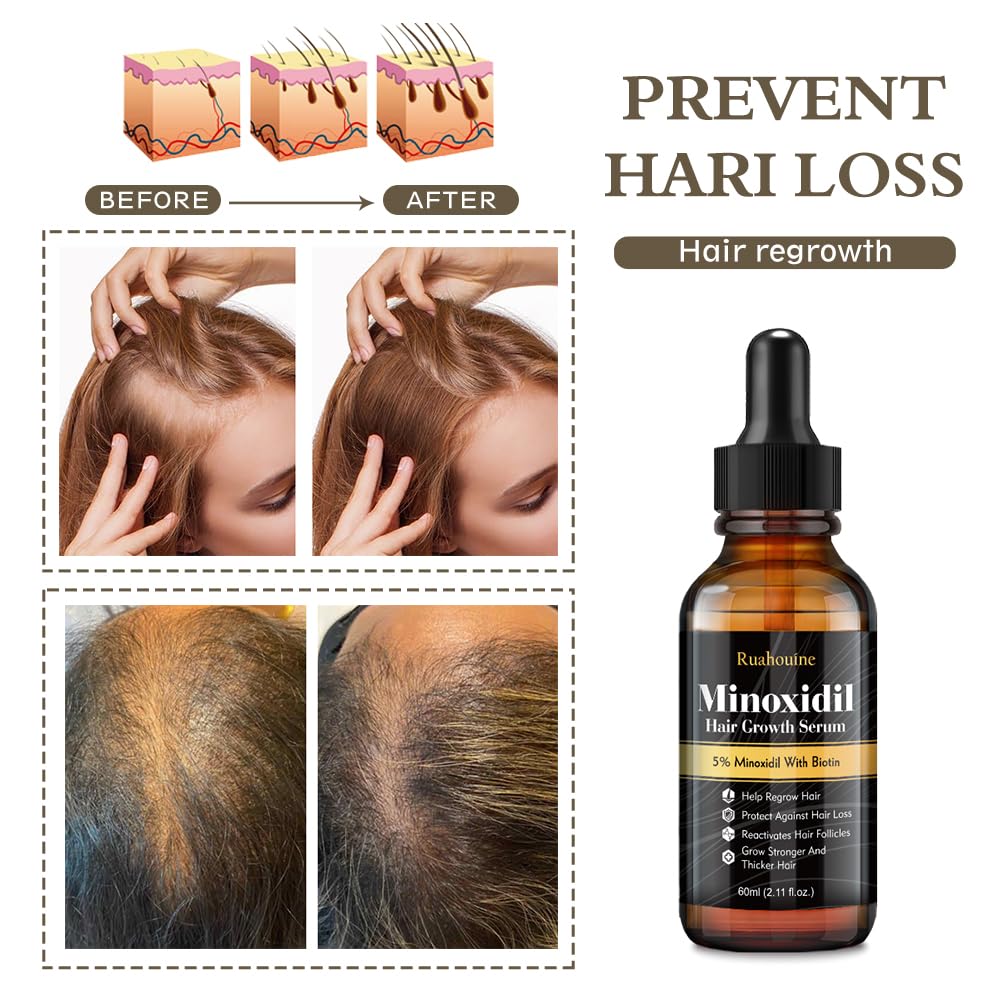 Hair Growth Serum Oil with 5% Minoxidil for Thicker Hair, 60ml Q62148