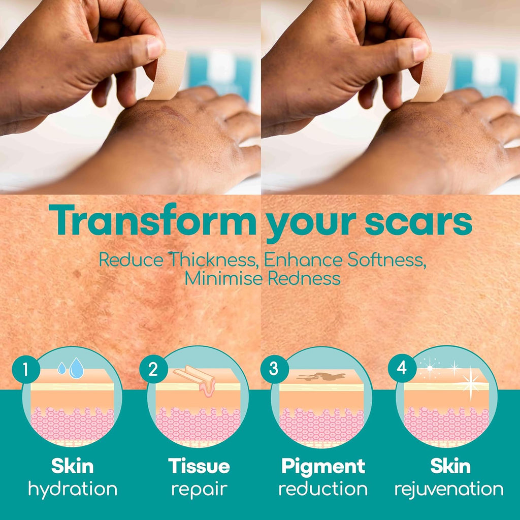 Silicone Scar Sheets, 80 Inches Long, Reusable with Storage Case L347