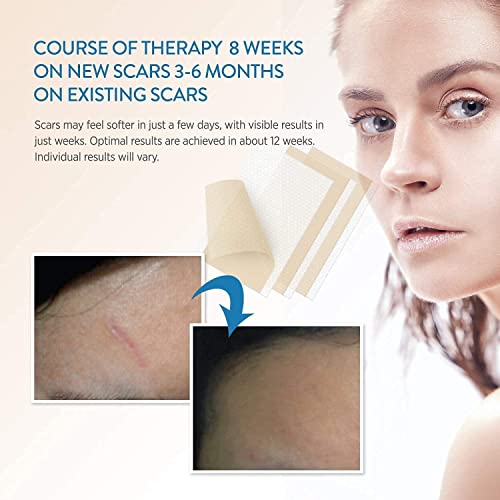 Soft Silicone Scar Sheets Strips for Surgery, Injury, Burns D269075