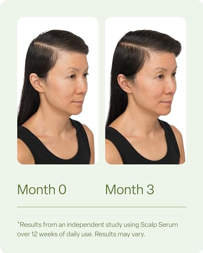 Scalp Serum for Thinning Hair, Nourishes and Balances Scalp, 100ml N59521