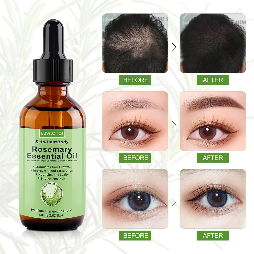 Rosemary Oil for Hair Growth, Pure Organic Essential Oil for Scalp and Hair S8575