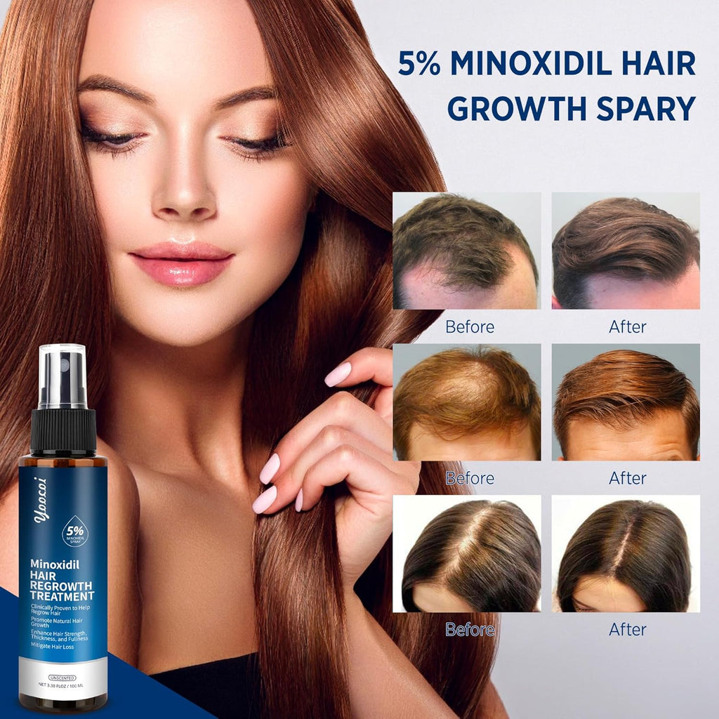 Hair Growth Serum with 5% Minoxidil for Thinning Hair, 100ml W43959