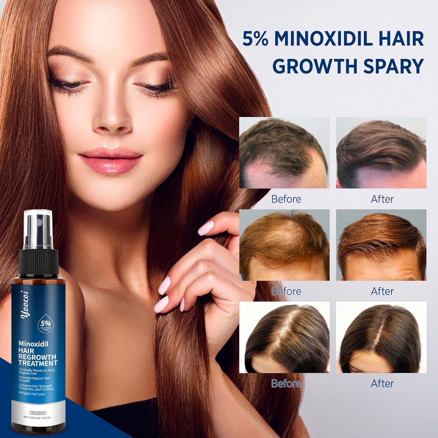 Hair Growth Serum with 5% Minoxidil for Thinning Hair, 100ml W43959