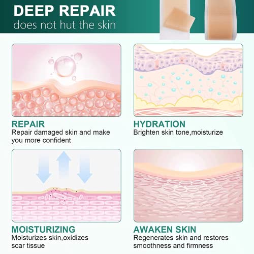 Silicone Scar Sheets for Surgical, Keloid, and C-Section Scars Z84648