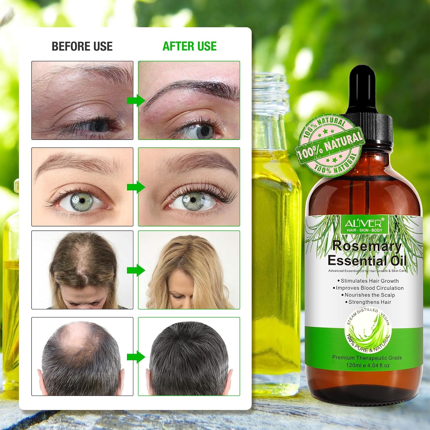 Rosemary Oil for Hair Growth with Scalp Massager V4016
