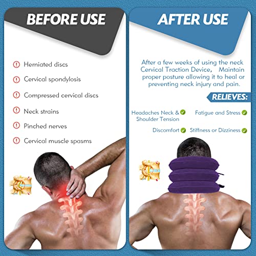 Adjustable Inflatable Neck Stretcher for Cervical Traction and Pain Relief A5759