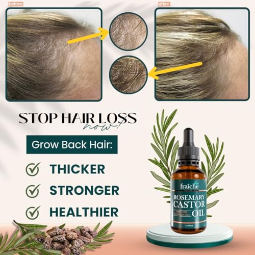 Rosemary and Castor Oil for Hair Growth, 2 oz Q73169