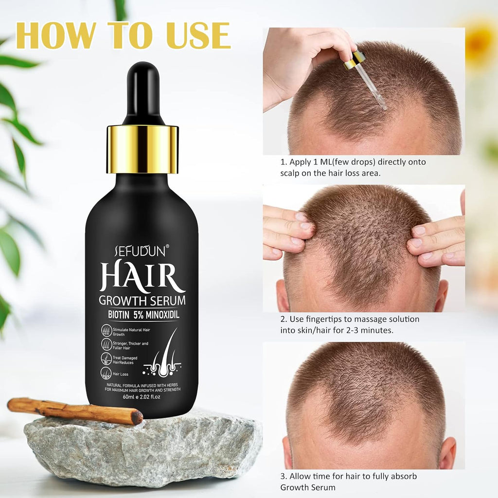 5% Minoxidil Hair Growth Serum for Men and Women D392