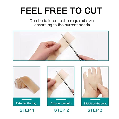 Silicone Scar Sheets Roll for C-Section, Surgery, Burn, Keloid, Acne I990