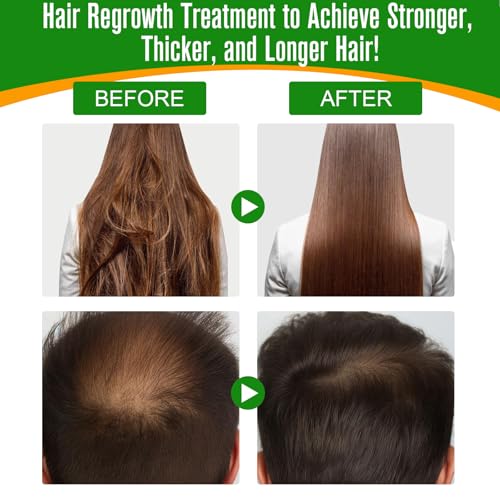 Rosemary Oil for Hair Growth, Pure for Scalp and Eyebrow V162100