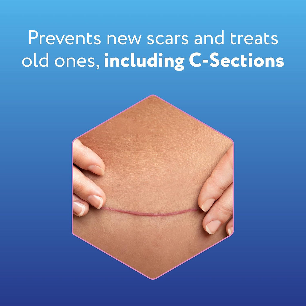 Silicone Scar Sheets for C-Section, Reusable, 4 Sheets U386