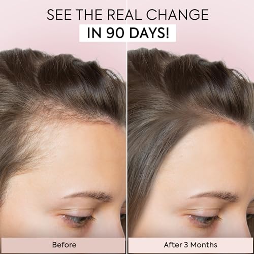 Hair Growth Serum for Thinning Hair, 1 Fl Oz H9135