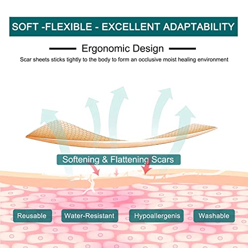 Silicone Scar Sheets Roll for C-Section, Surgery, Burn, Keloid, Acne I990