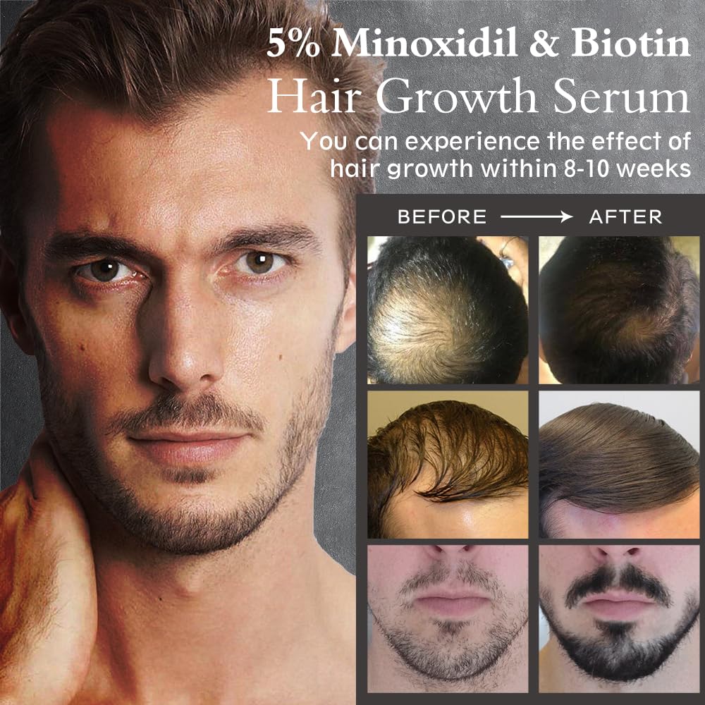 Hair Growth Serum Oil with 5% Minoxidil for Thicker Hair, 60ml Q62148